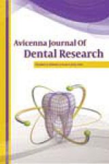Gingival Enlargement: A Review Article